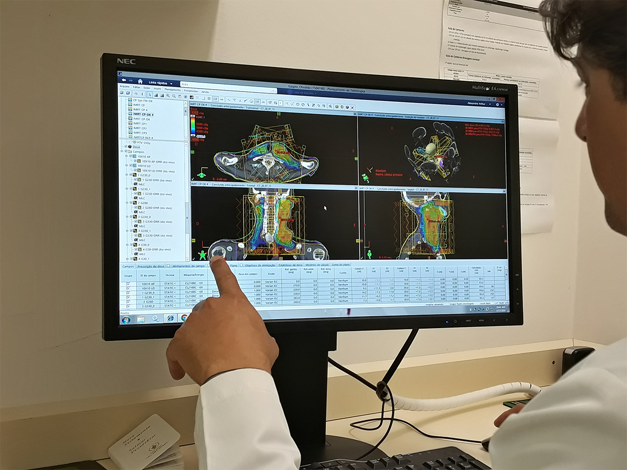 Pioneirismo: HA publica estudo para tratamento com radioterapia acelerada