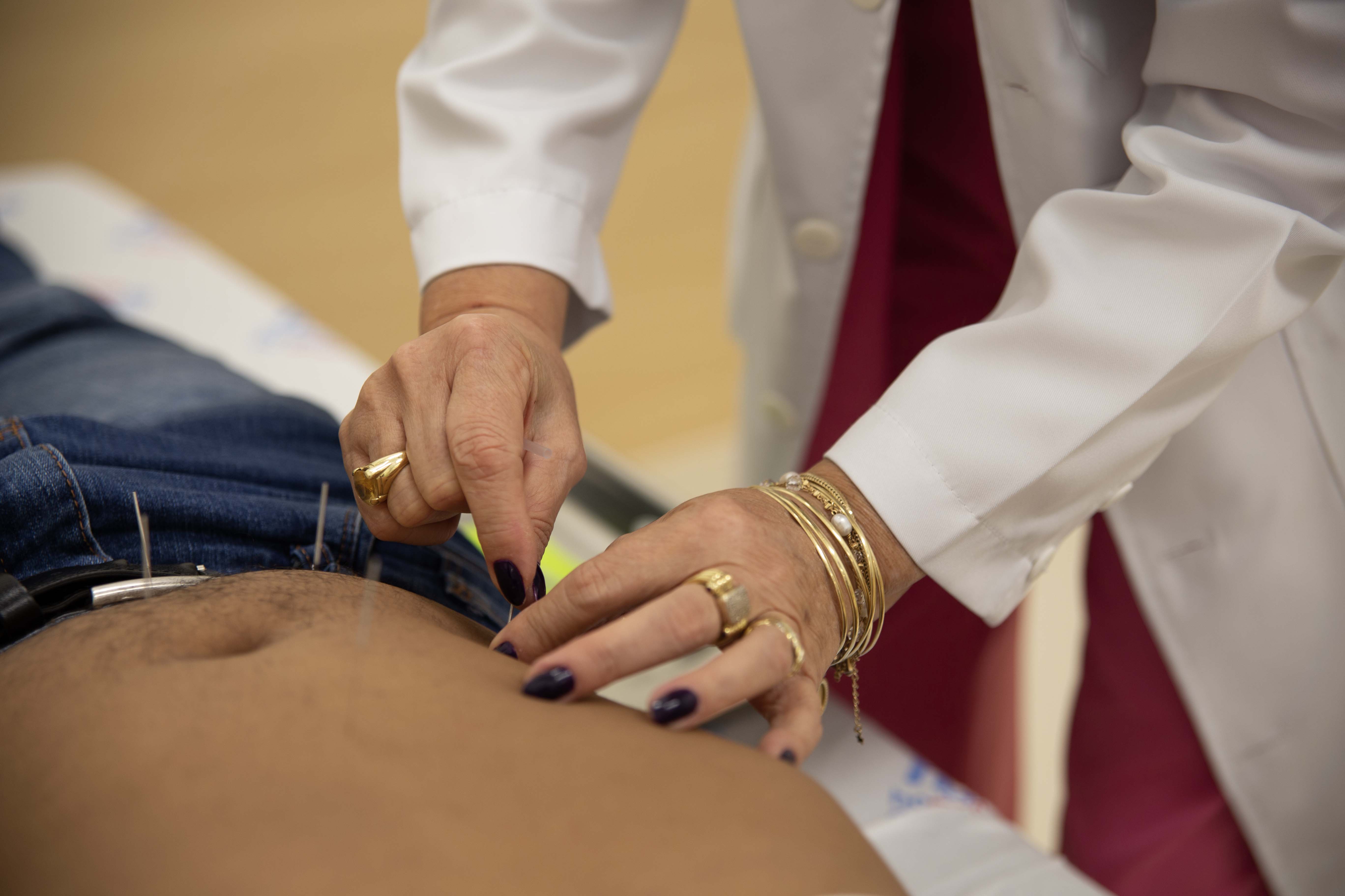 Acupuntura auxilia na reabilitação dos pacientes do HA