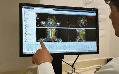 Pioneirismo: HA publica estudo para tratamento com radioterapia acelerada