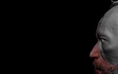 HA reabilita paciente com prótese facial moldada com tecnologia 3D