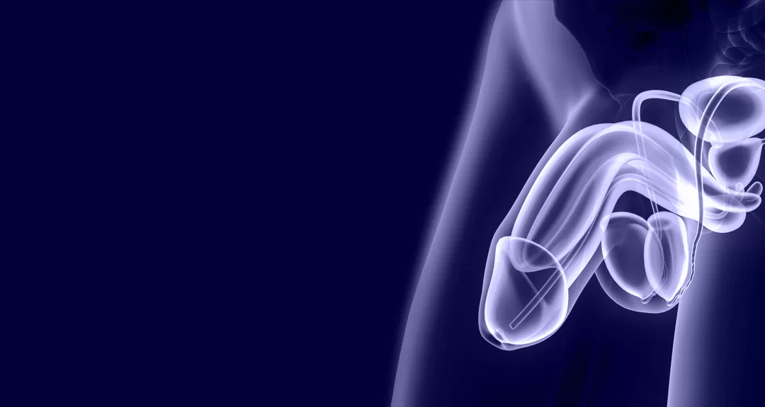 Câncer de pênis: 25% dos casos levam à amputação no Brasil