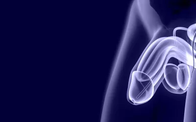 Câncer de pênis: 25% dos casos levam à amputação no Brasil