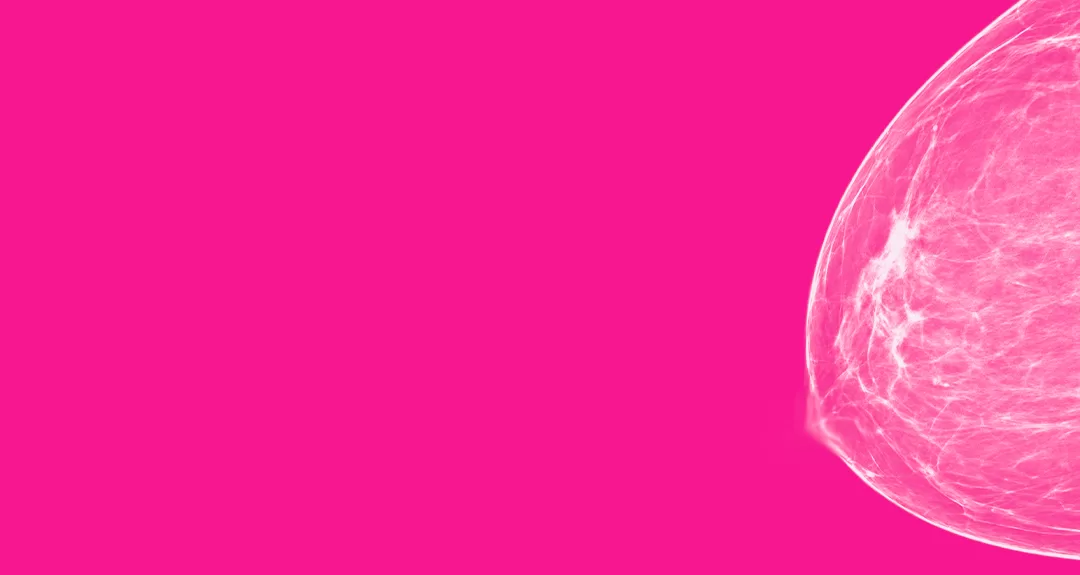 “Outubro Rosa”: ancestralidade pode ser risco para câncer de mama