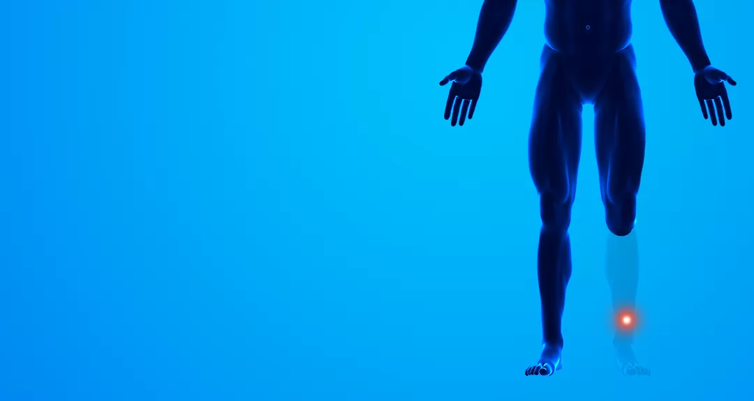 Você sabe o que é dor fantasma?