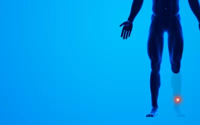 Você sabe o que é dor fantasma?