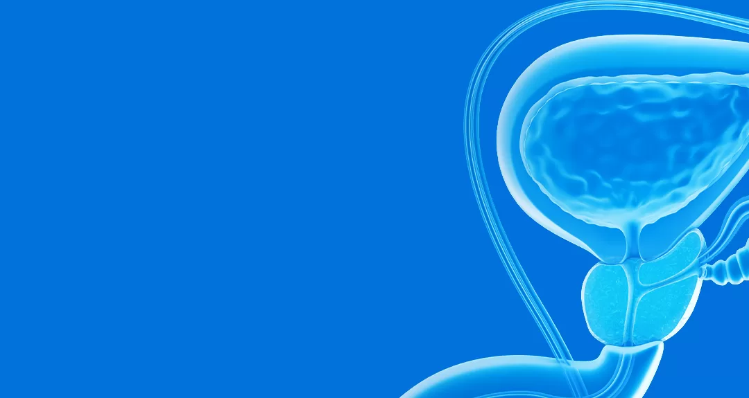 “Novembro Azul”: saiba tudo sobre o câncer de próstata