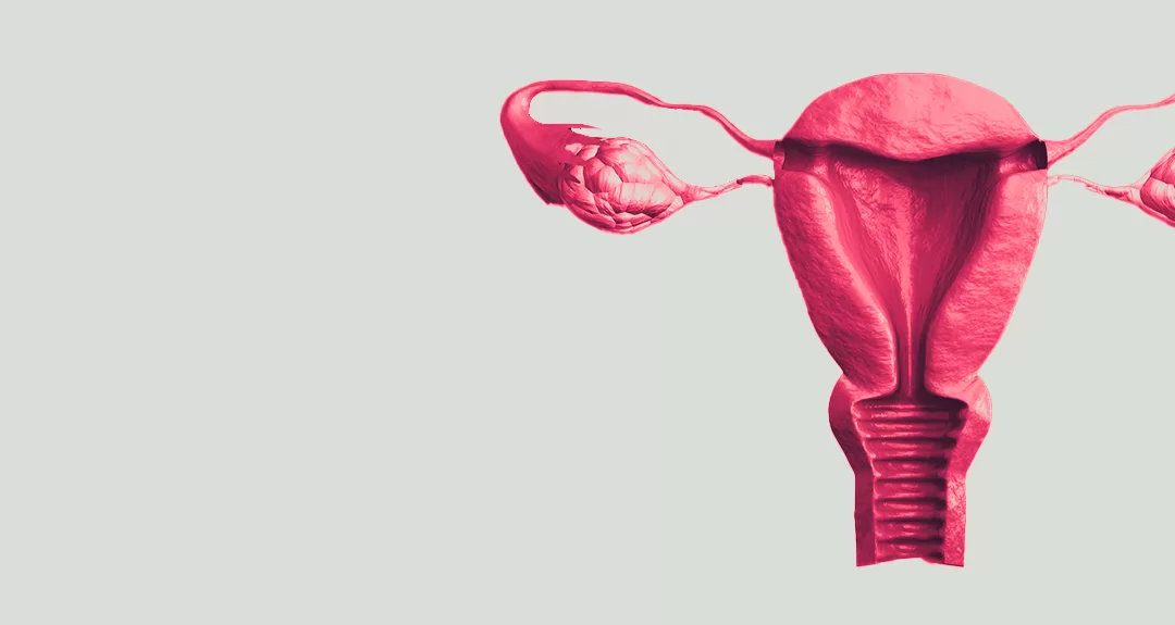 Barretos possui o maior índice de detecção precoce do câncer de colo uterino em SP