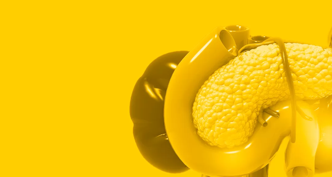 Câncer de Pâncreas: saiba tudo sobre a doença