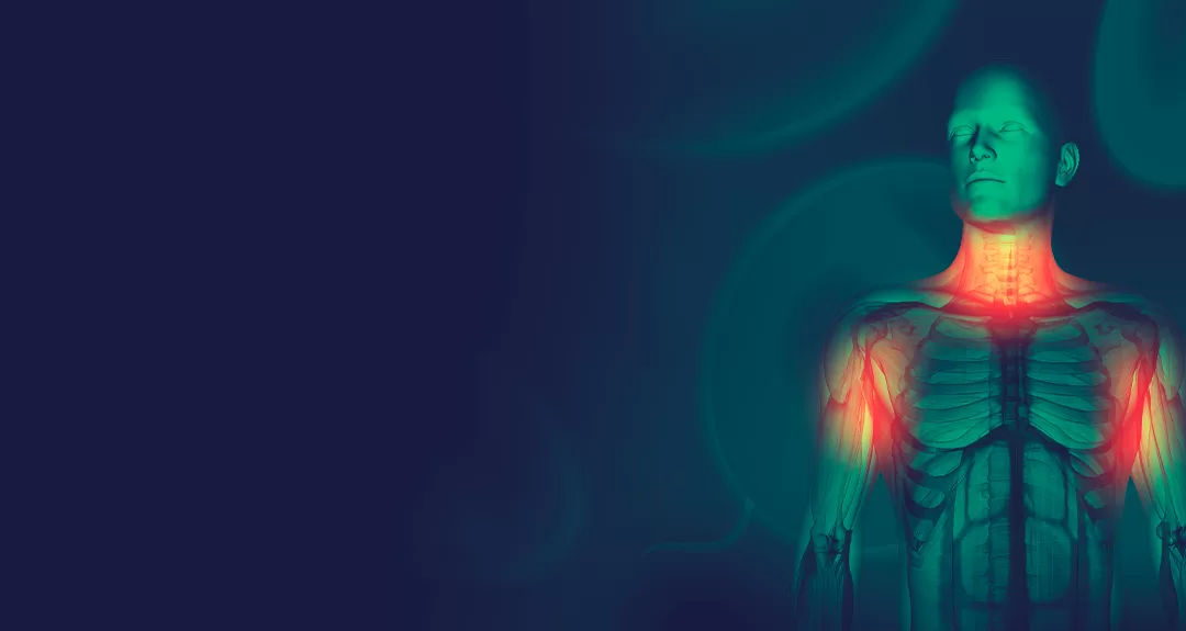 Linfoma de Hodgkin: conheça o padrão ouro para tratamento da doença