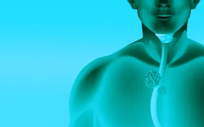 Câncer de Esôfago: Prevalência e Fatores de Risco no Brasil