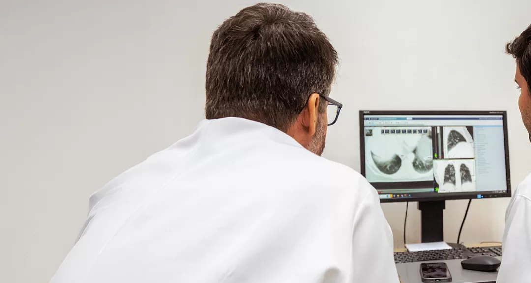 Câncer de pulmão: HA une tecnologia, ciência e prevenção para mudar cenário da doença no Brasil