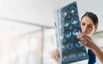 Quando um tumor é câncer? Entenda as diferenças e os tratamentos